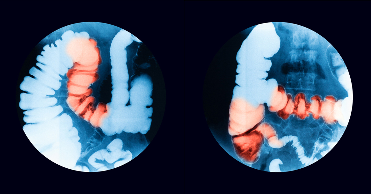 Diagnostic Imaging McKenzieWillamette Medical Center